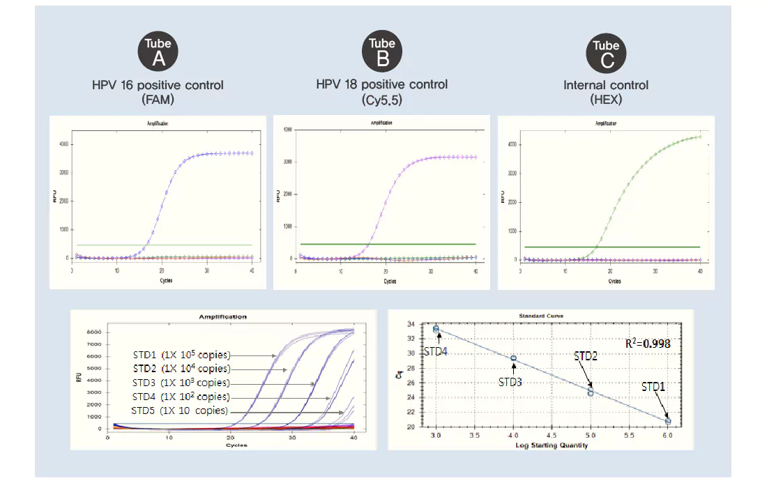 Mediforum MF HPV QE14 Results