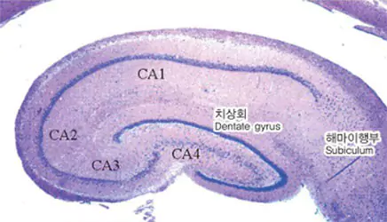 Dissected View of the Hippocampus