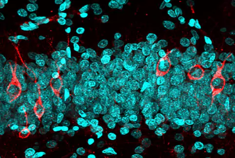 PM-012 Brain Neurogenesis