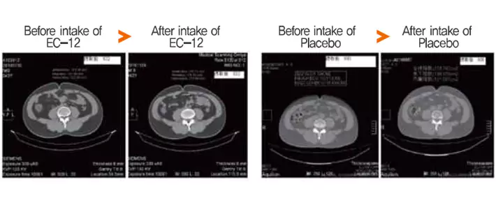 Qurelac Visceral Fat Reduction